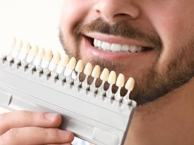 bonding, bonding chorzów, dentysta dziecięcy chorzów, implanty chorzów, licówki kompozytowe chorzów