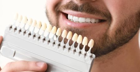 bonding, bonding chorzów, dentysta dziecięcy chorzów, implanty chorzów, licówki kompozytowe chorzów