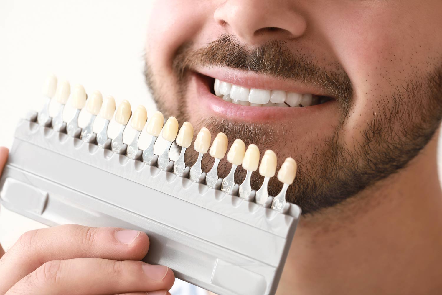 bonding, bonding chorzów, dentysta dziecięcy chorzów, implanty chorzów, licówki kompozytowe chorzów