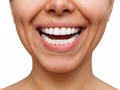 bonding, bonding chorzów, dentysta dziecięcy chorzów, implanty chorzów, licówki kompozytowe chorzów
