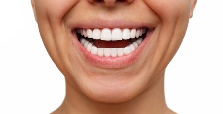 bonding, bonding chorzów, dentysta dziecięcy chorzów, implanty chorzów, licówki kompozytowe chorzów
