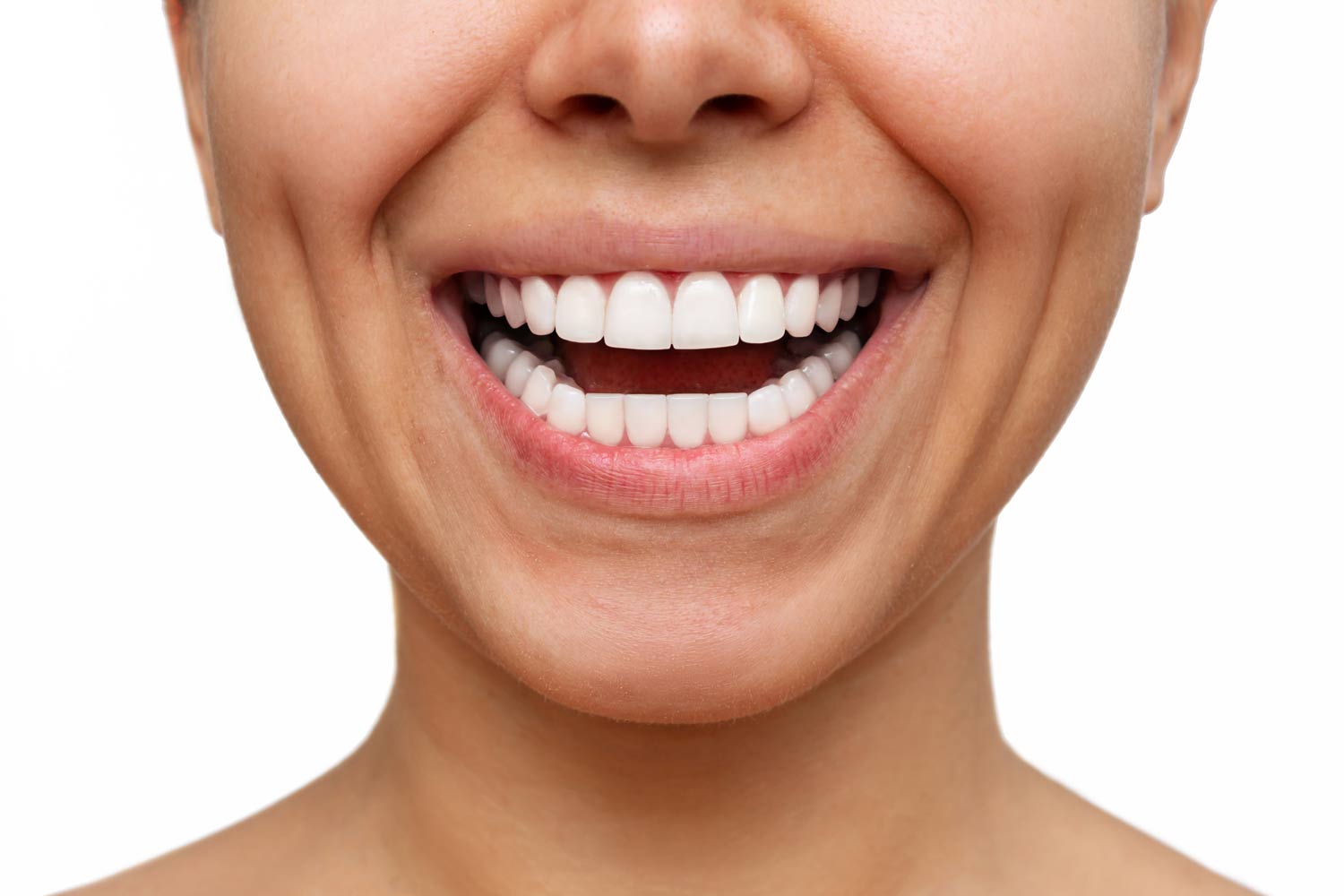 bonding, bonding chorzów, dentysta dziecięcy chorzów, implanty chorzów, licówki kompozytowe chorzów